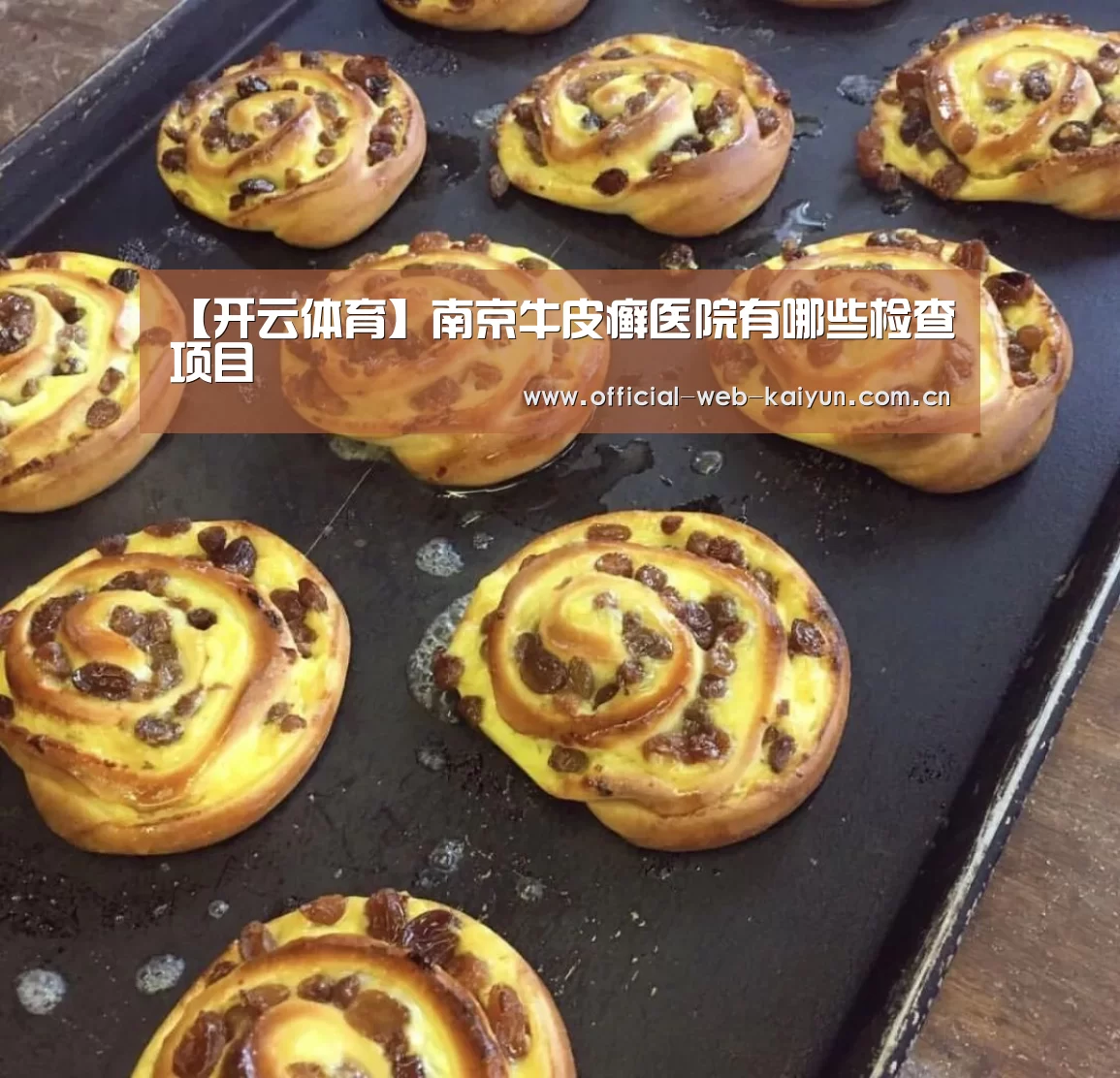 【开云体育】南京牛皮癣医院有哪些检查项目(图2) 开云体育